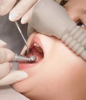 Medical Anesthesia Gas